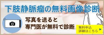 下肢静脈瘤の無料画像
